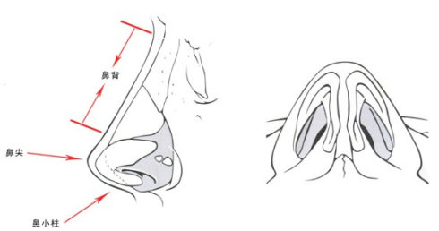 隆鼻的效果怎么样