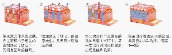 荆门激光美容怎么样?