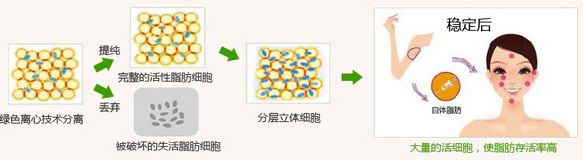 太阳穴凹陷怎么办?