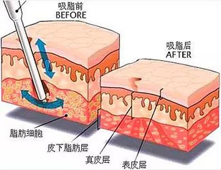 与寻美者耐心沟通，将你的想法通过艺术手段还原