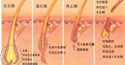 武汉冰点脱毛的效果可以维持多久?