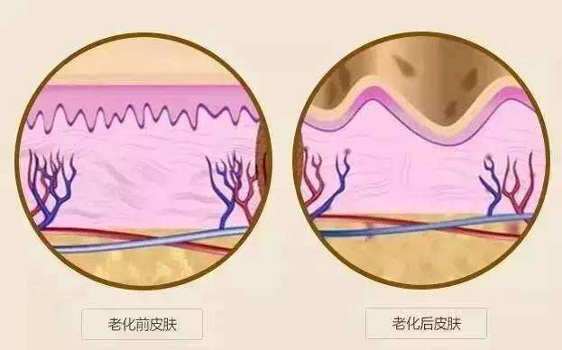 武汉电波拉皮除皱的效果怎么样